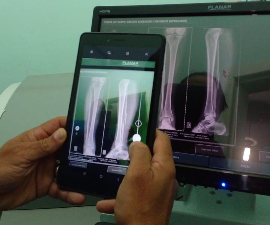 Anchieta inicia serviço de traumatologia para urgências no Pronto Atendimento