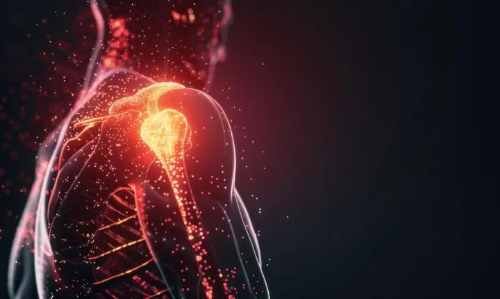 Novos procedimentos tratam a dor no ombro sem cirurgia