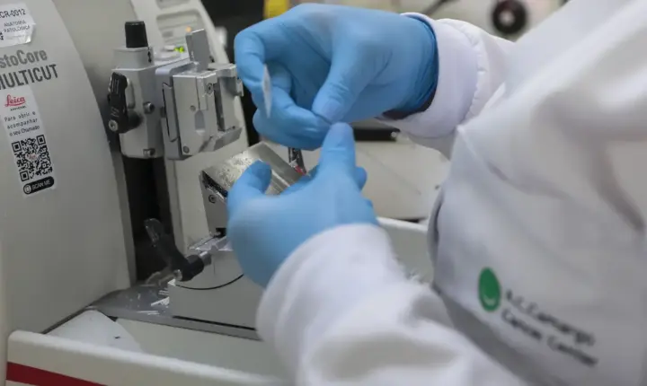 SUS inclui nova terapia para pacientes adultos com leucemia mieloide